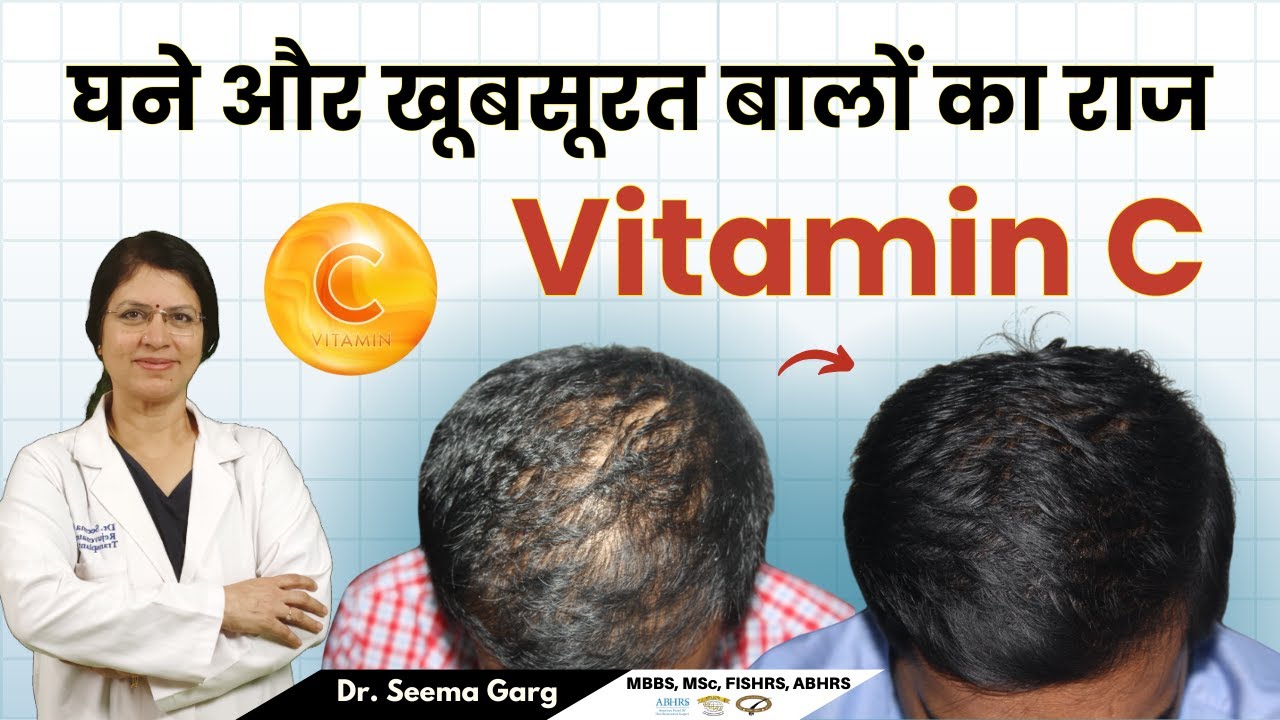 Vitamin C से पाएं नेचुरली घने और खूबसूरत बाल! | Vitamin C for Thick & Healthy Hair