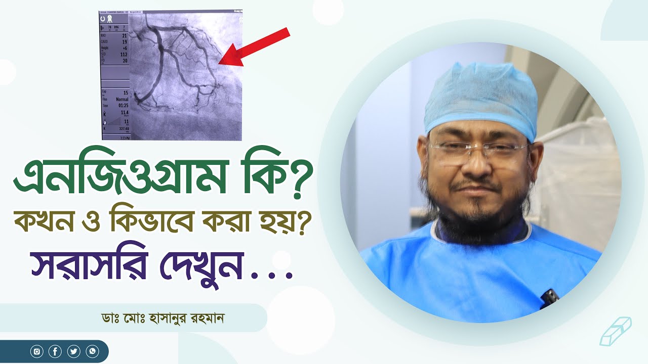 এনজিওগ্রাম কি? কখন ও কিভাবে করা হয়? সরাসরি দেখুন What is angiogram? When and how is it done?