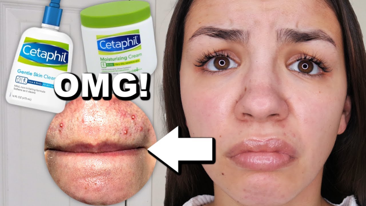 I Used Cetaphil Skincare For One Week!