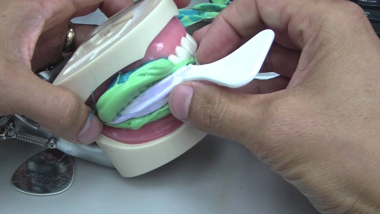 Crown Impression Tips Part 3