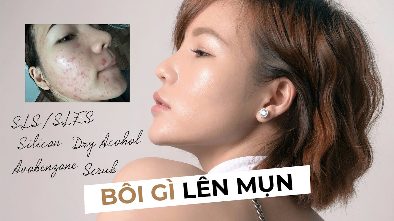 INGREDIENT - BÔI GÌ BỊ LÊN MỤN? - Phân tích thành phần càng dùng càng lên mụn