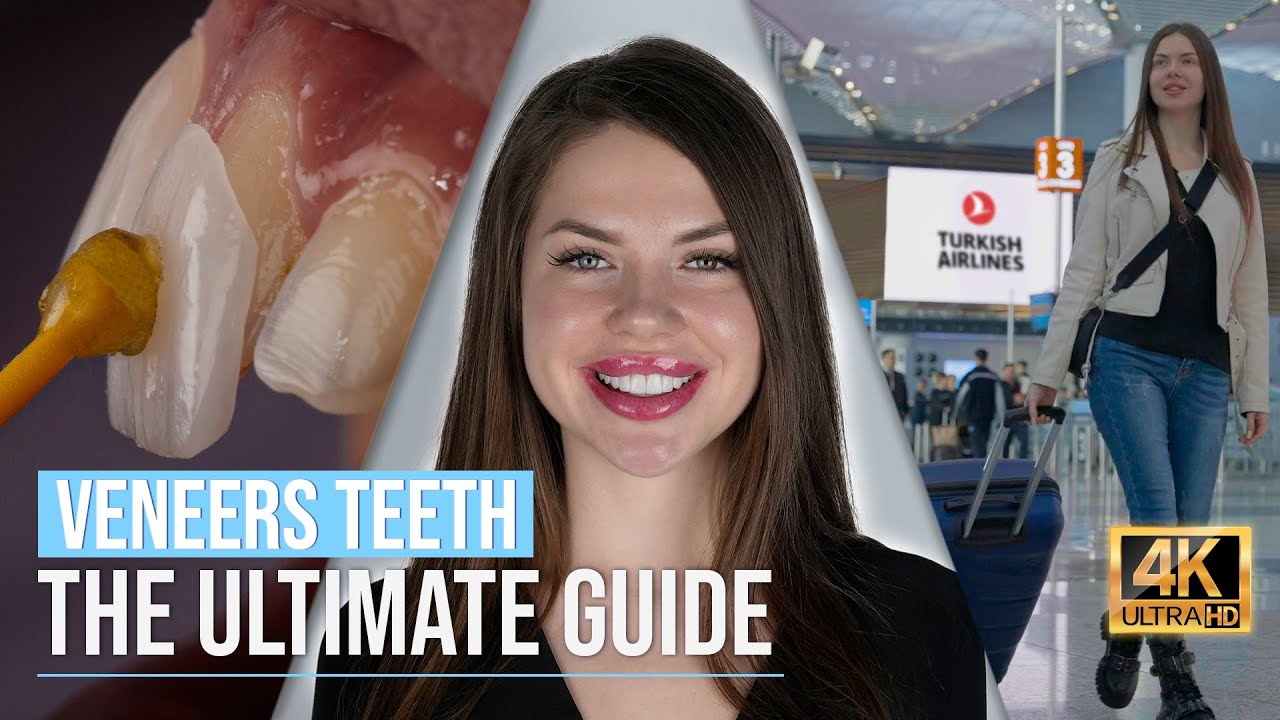 Your Ultimate Guide to Having Veneers teeth in Turkey