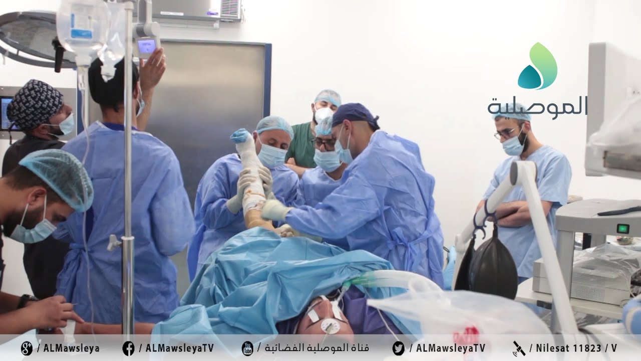 أطباء مستشفى الجمهوري التعليمي ينجحون في إجراء عملية زرع رباط صليبي لرياضي من محافظة نينوى