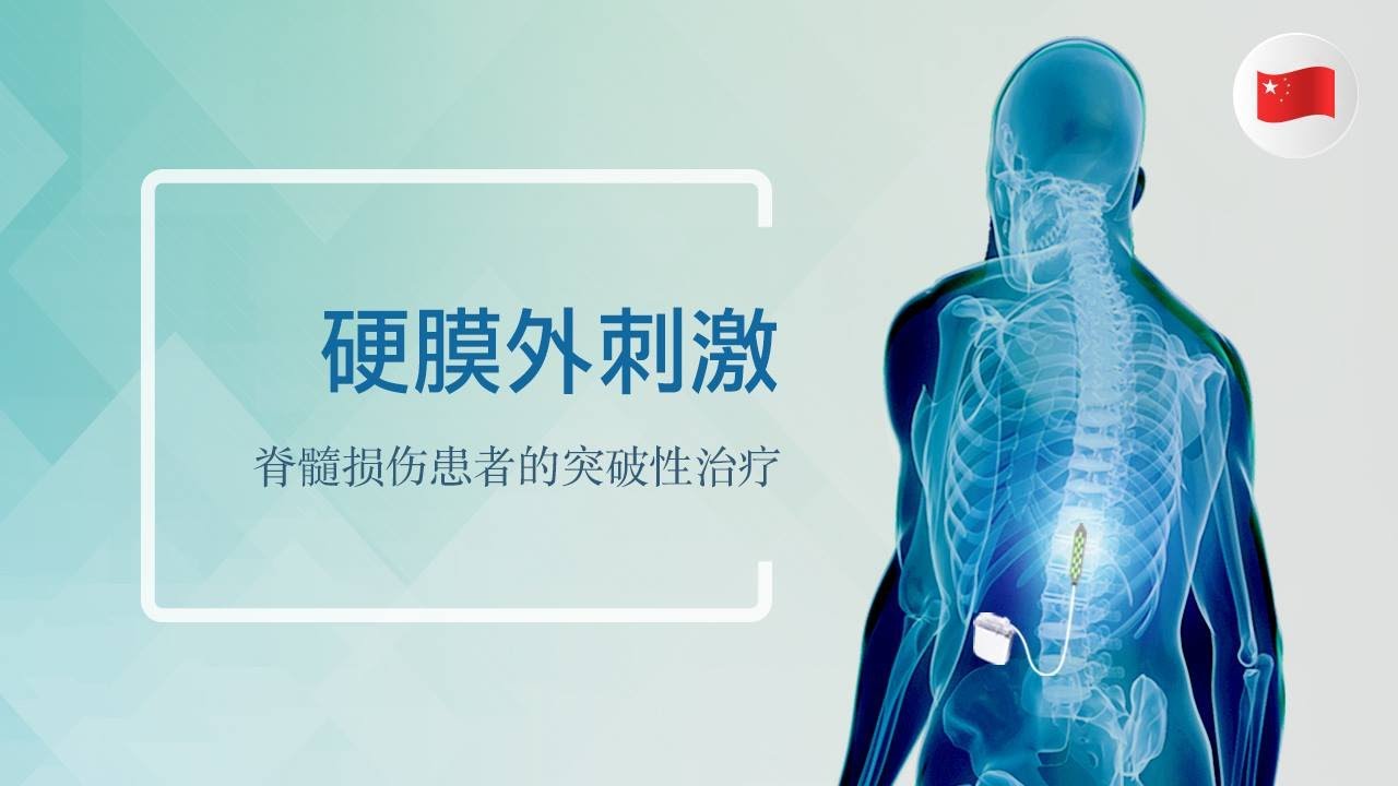 硬膜外刺激: 脊髓损伤患者的突破性治疗 (Extended)