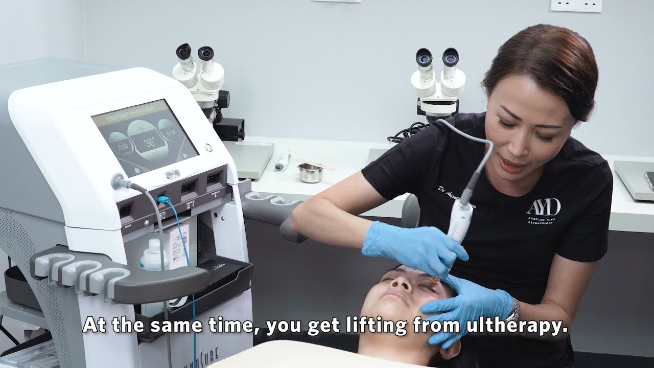 Getting a Tempsure Envi Treatment Combined with Ultherapy (HiFU)