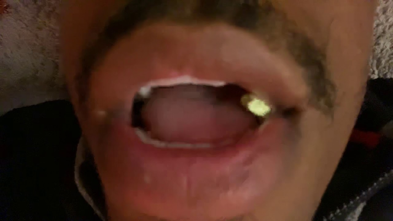 Asmr gum chewing