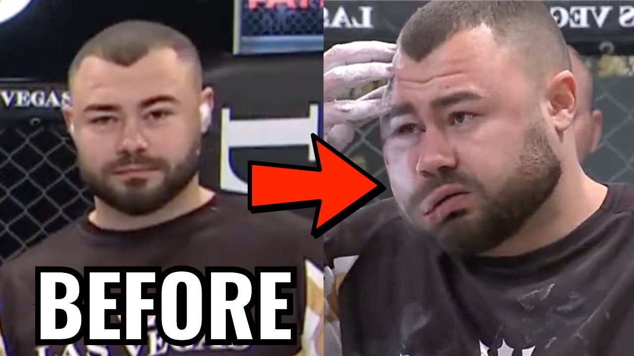 Drooping Face After Slap Fighting Victory - Doctor Explains