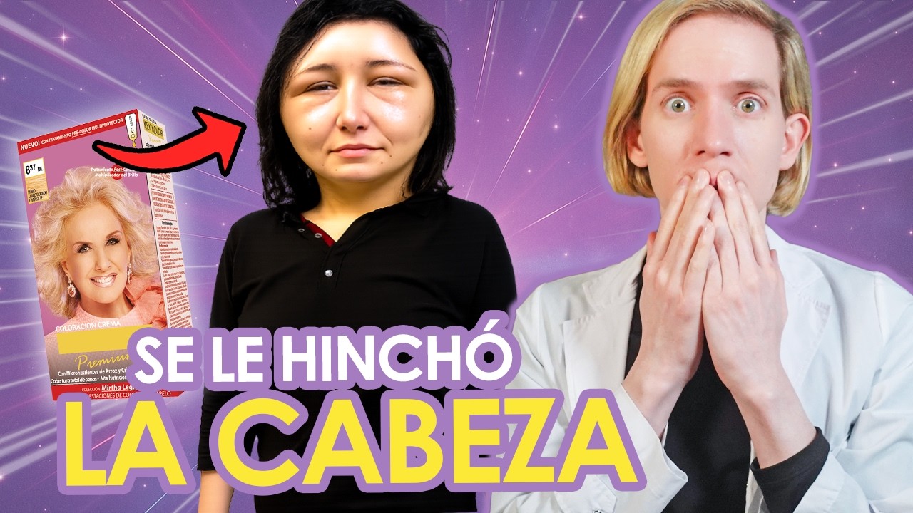 SE TIÑÓ EL PELO y CASI SE DESVIVE  - Se le AGRANDÓ LA CABEZA -  ¿Teñirse es peligroso?