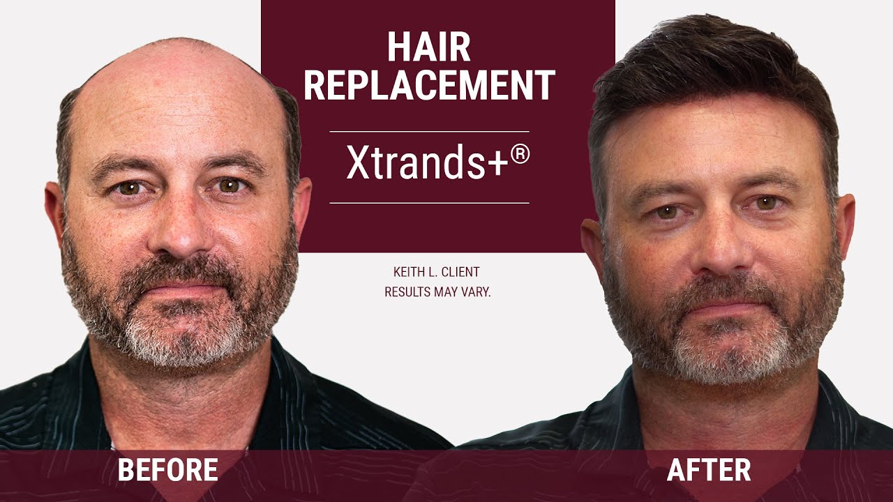 Striking hair transformations [Hair Replacement Solutions by HairClub]