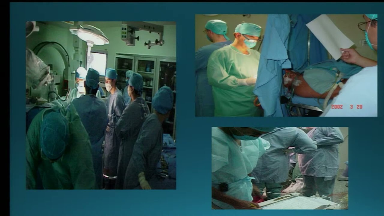 2. Neuroanestesia en Cirug&iacute;a de Epilepsia: t&eacute;cnica del paciente... Dr. Eduardo Hern&aacute;ndez Bernal