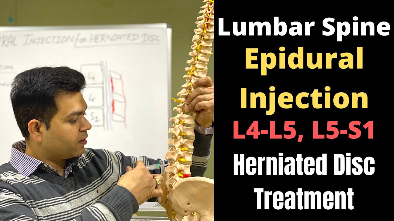Spinal Injections for Lower Back Pain, Epidural Steroid Injection for Sciatica, Spine Injection