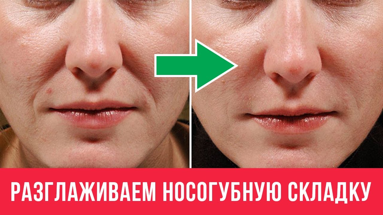 ❎КАК УБРАТЬ НОСОГУБНЫЕ СКЛАДКИ в домашних условиях? Упражнение от носогубных складок: Фейсбилдинг