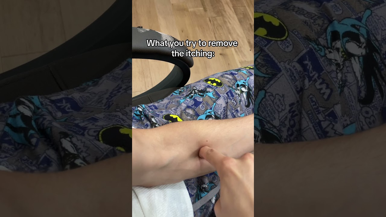 we are talking about mosquitos 💀#mosquito #fyp #aura #war #freak #funny