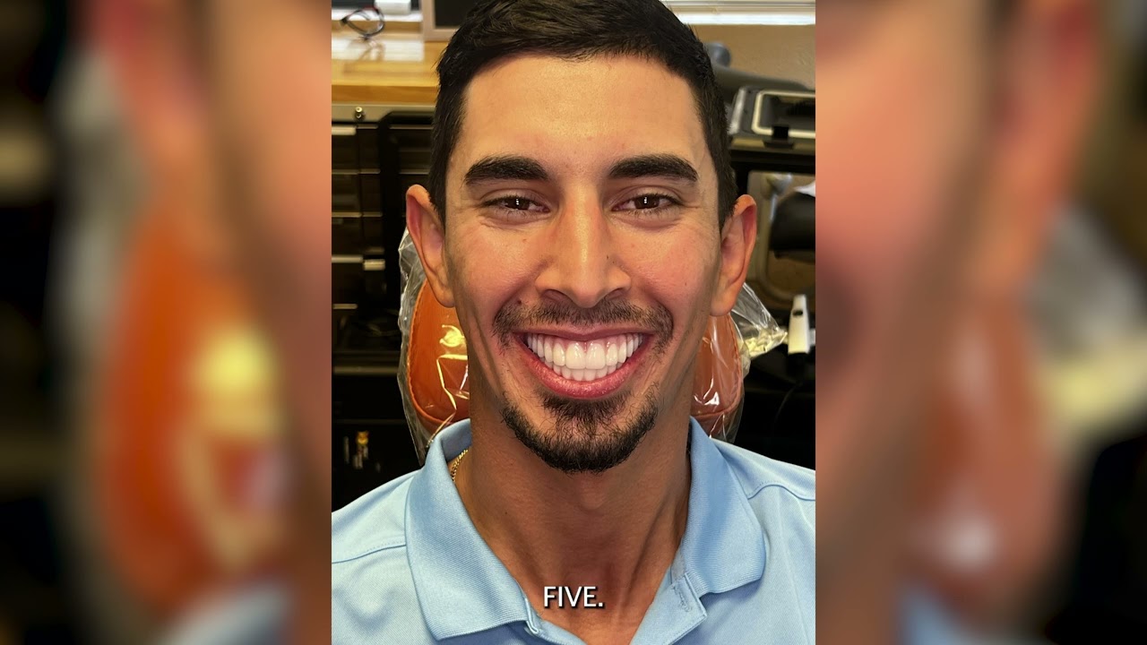 David's Full Journey - Full arch Masters