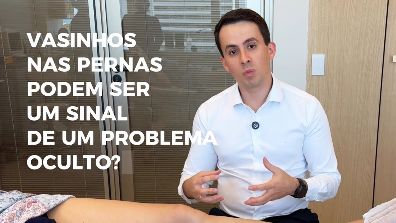 Vasinhos nas pernas podem ser um sinal de um problema oculto?