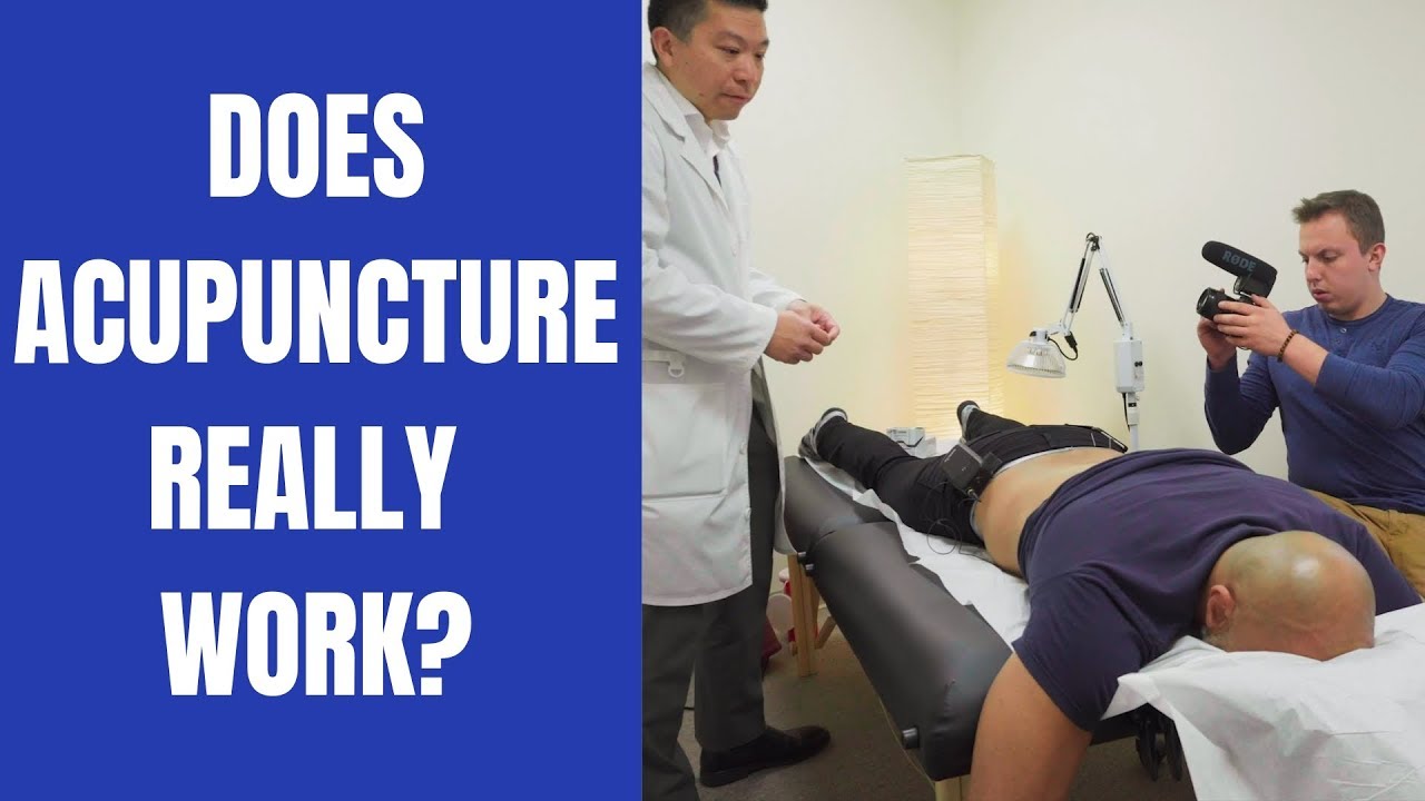 DOES ACUPUNCTURE REALLY WORK?
