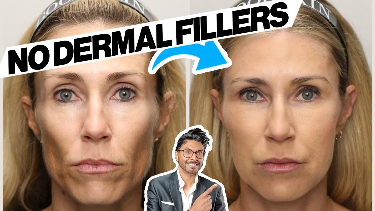 Renuva: Grow Fat Back In Your Face? No More Fillers?