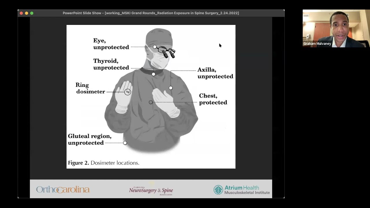 Radiation Exposure in Spine Surgery   Graham Mulvaney