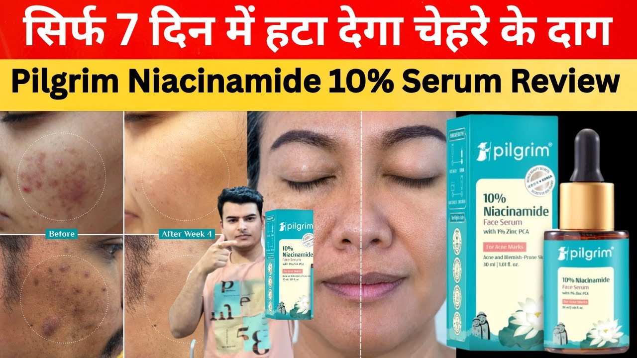 Pilgrim Niacinamide Serum | Niacinamide serum for face | Pilgrim Niacinamide Serum review