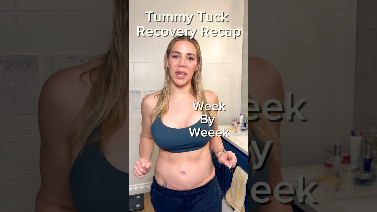 Восстановление после абдоминопластики неделя за неделей #обзор #дряблаякожа #операция #послеопера...