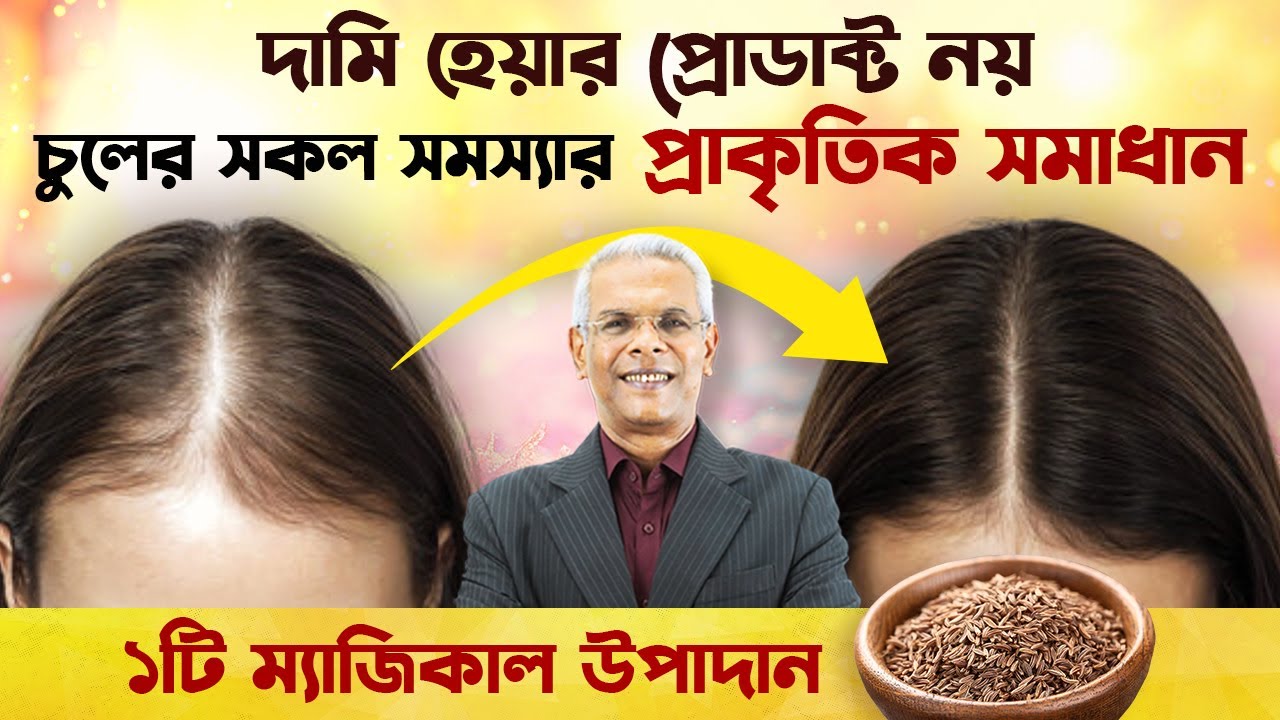 চুল পড়া, খুশকি আর হেয়ার গ্রোথ—সব সমাধান ১ উপাদানে! Solution To All Your Hair Problems। Linnet