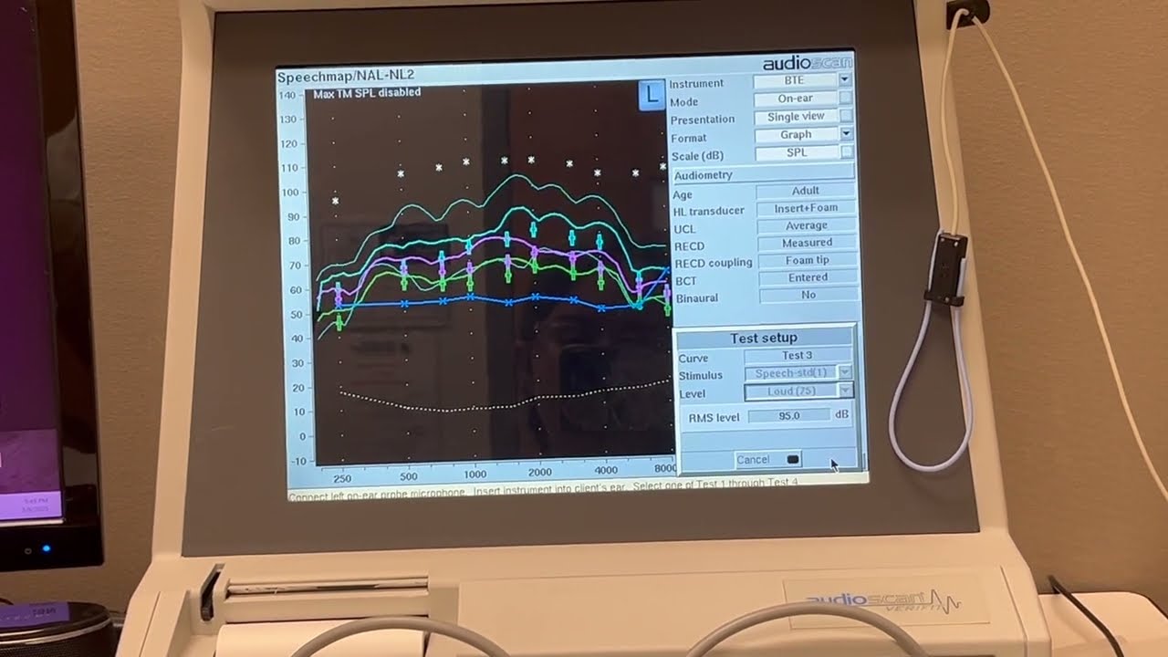 Verifit 1 speechmapping on ear