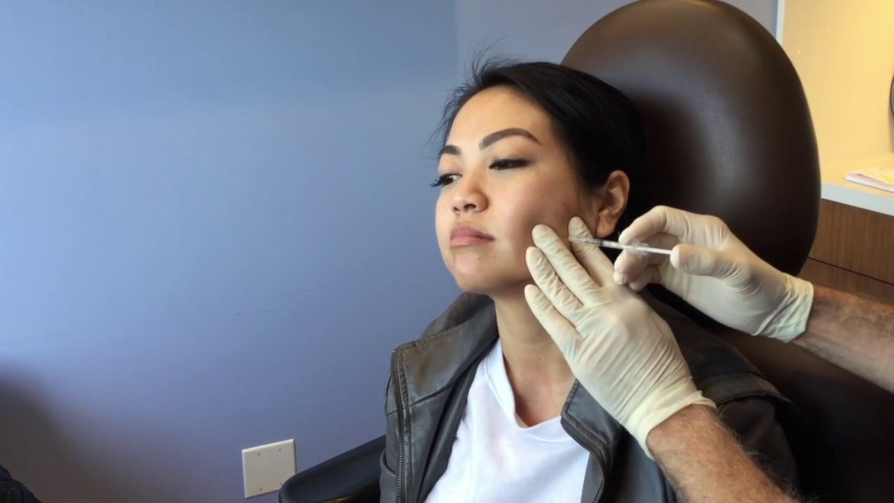 Jaw Reduction Using Botox