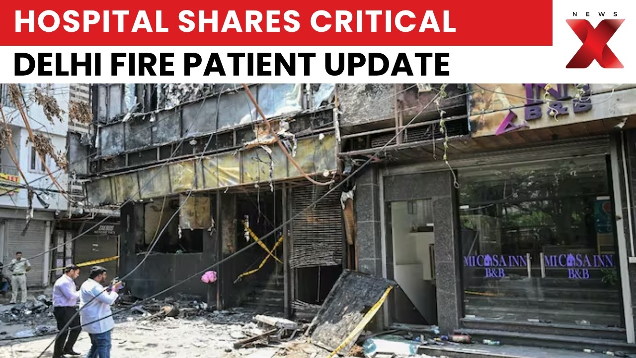 Malviya Nagar Fire Tragedy: Max Hospital Shares Critical Health Update On Patients | NewsX