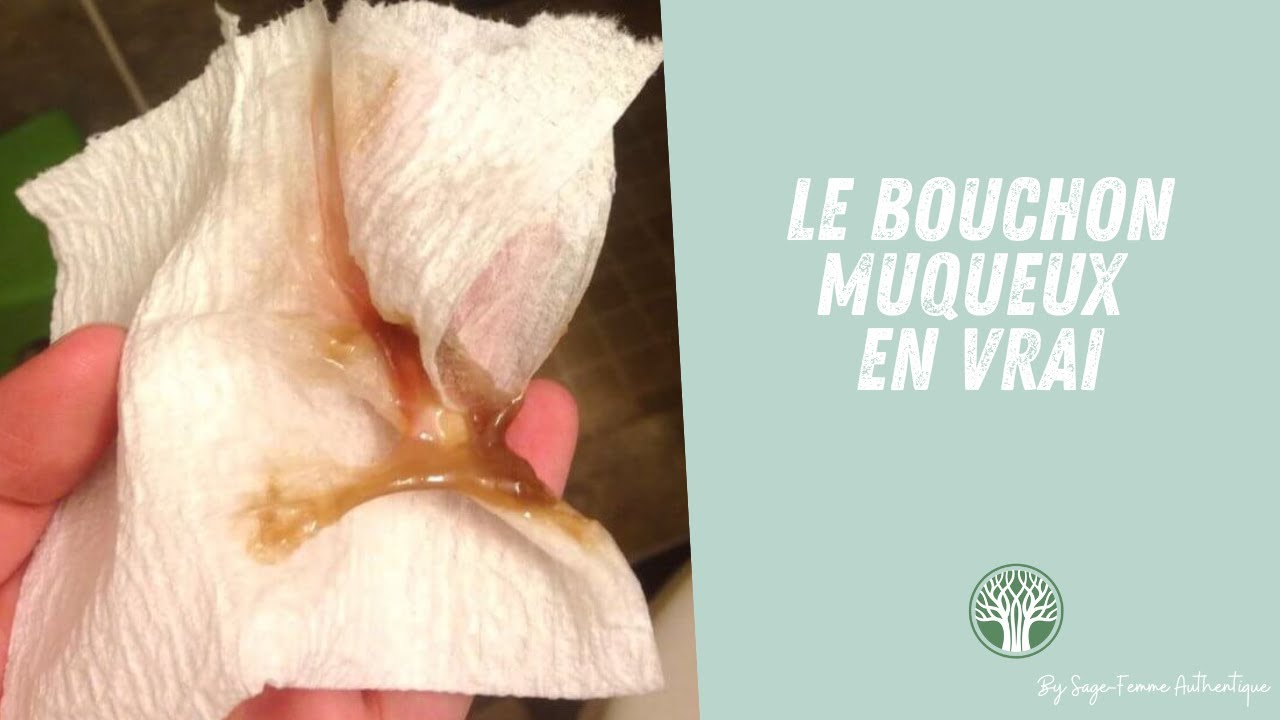 Le bouchon muqueux en vrai QSF41