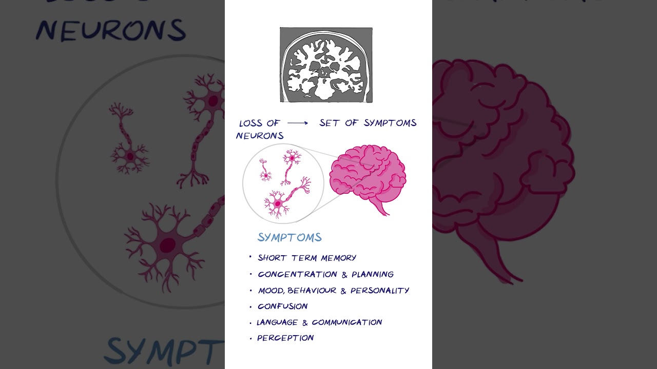 Dementia EXPLAINED #healthsketch #shorts