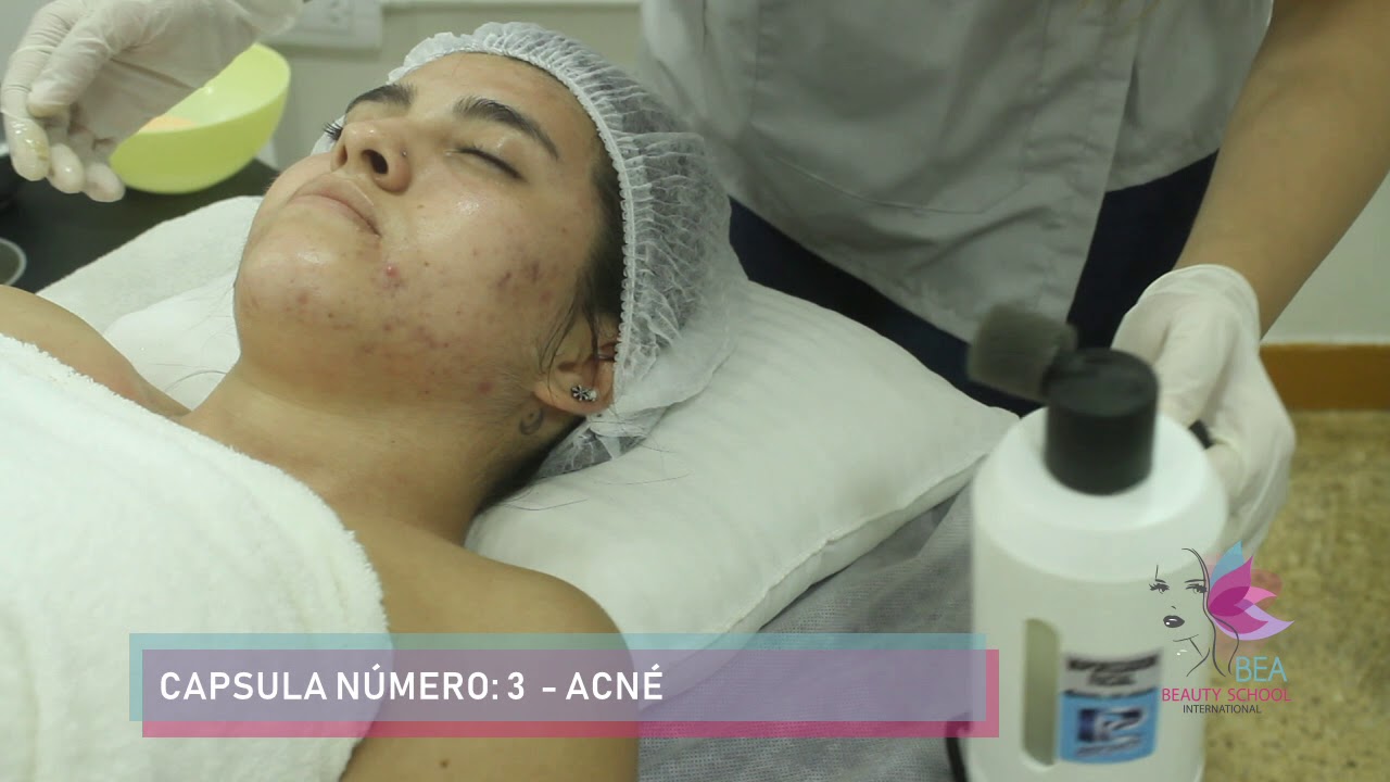 CAPSULA 3 ACNE
