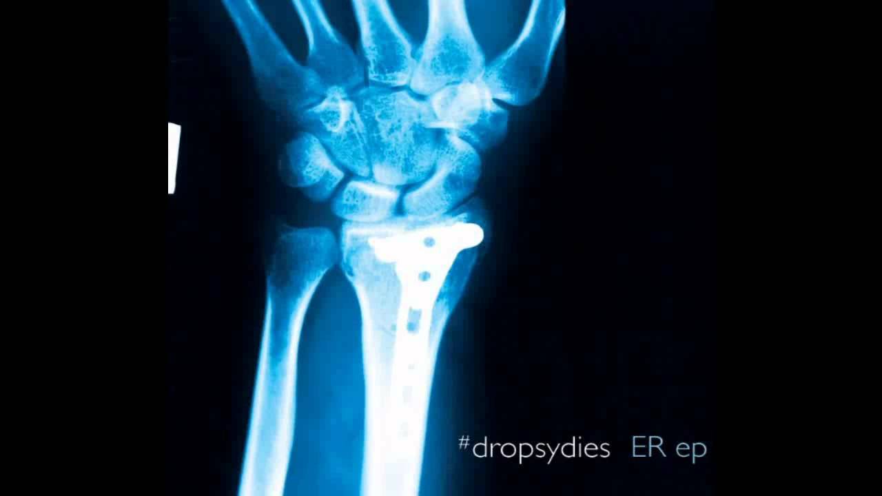 #dropsydies - ER