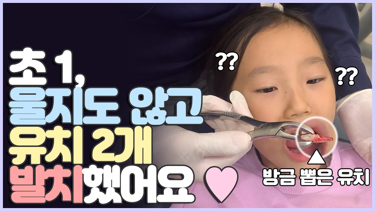 Since 2003 부천 바로이치과 영구치 교정을 위해 전혀 흔들리지 않는 유치 안 아프게 발치하기｜부천치과 부천역치과