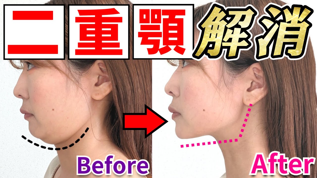 【二重あご専用】顔ヨガ＆舌トレでたるんだアゴ肉 超スッキリ！!