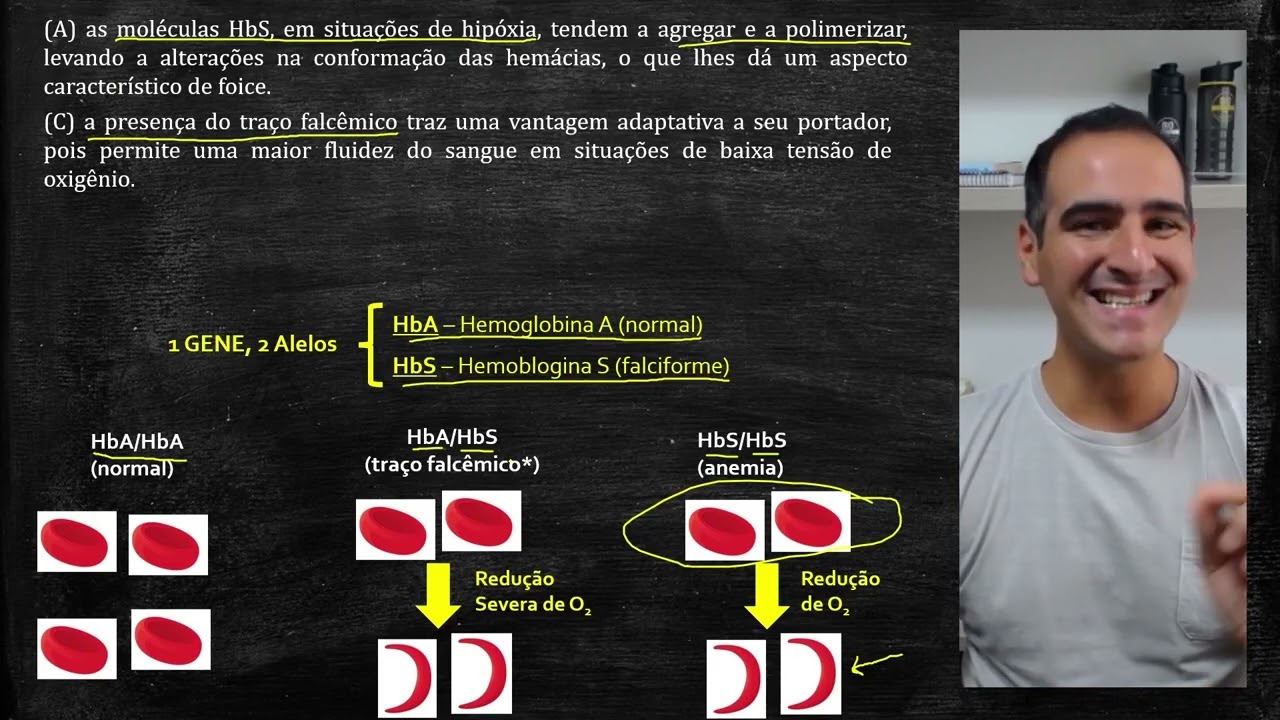 UFRGS 2025 | BIOLOGIA | QUESTÃO 49 | A anemia falciforme é uma condição hematológica genética