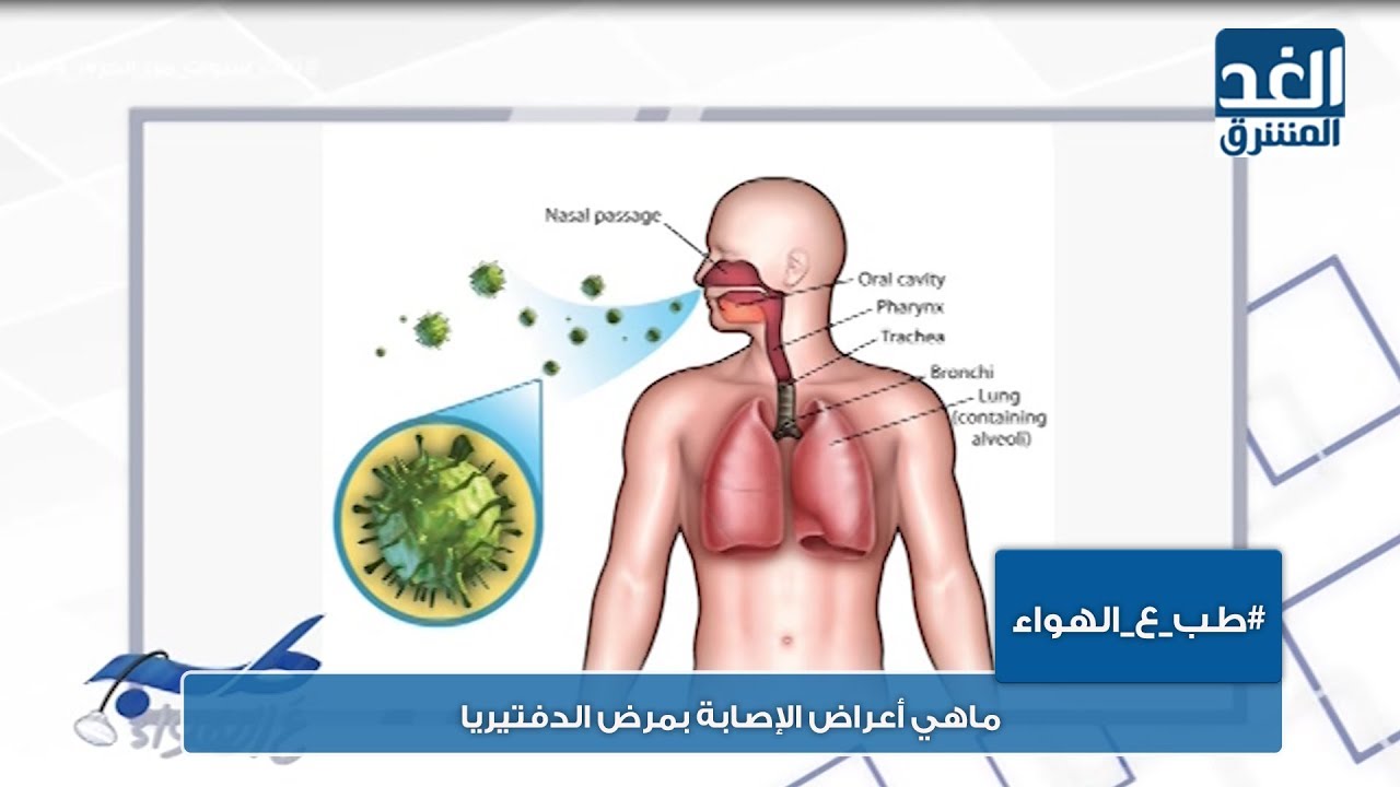 طب ع الهواء | ماهي أعراض الإصابة بمرض الدفتيريا