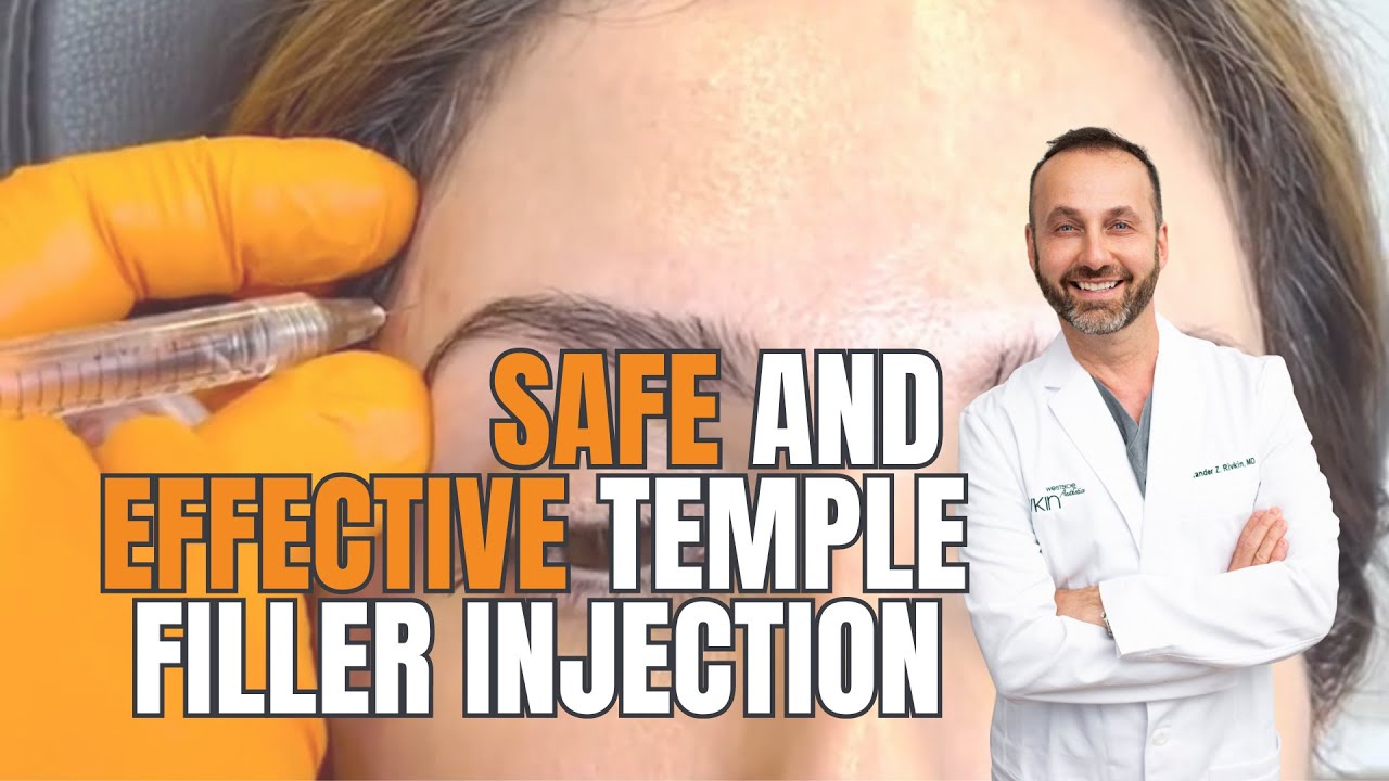 Safe temple filler injection #templefiller #dermalfillers #dermalfiller