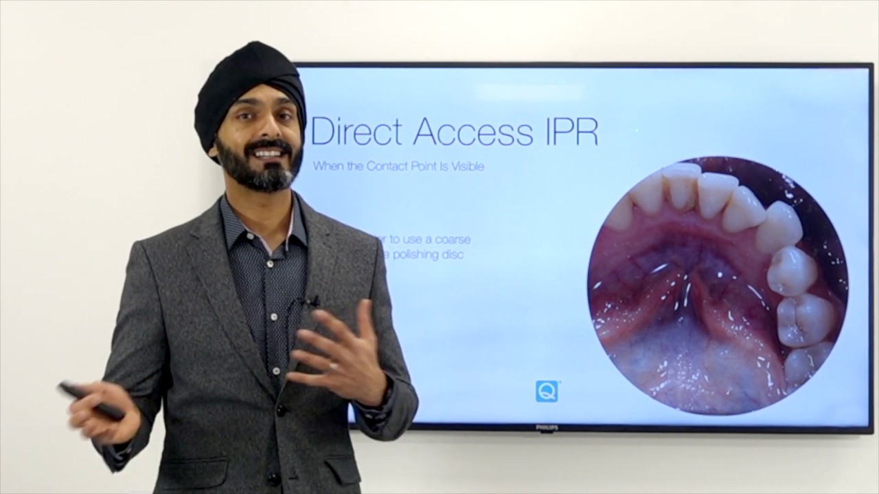 Clear Aligners IPR and Attachments