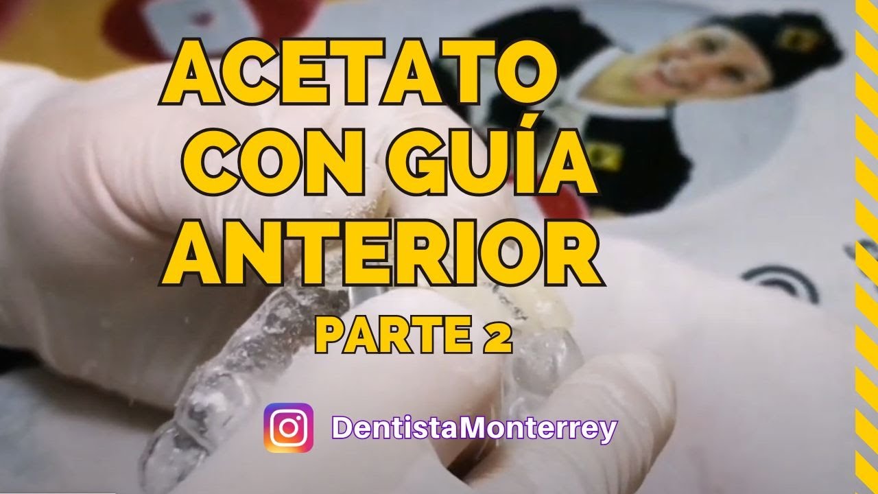 Acetato con GUÍA ANTERIOR 👅 Parte2 REBASE de Férula