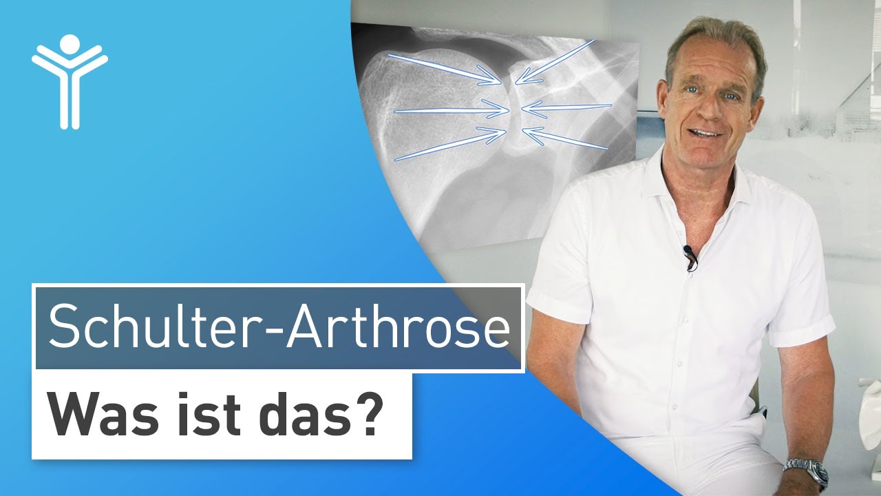 Arthrose der Schulter: Was ist die Schulterarthrose und wie kommt es zum Gelenkverschlei&szlig;?