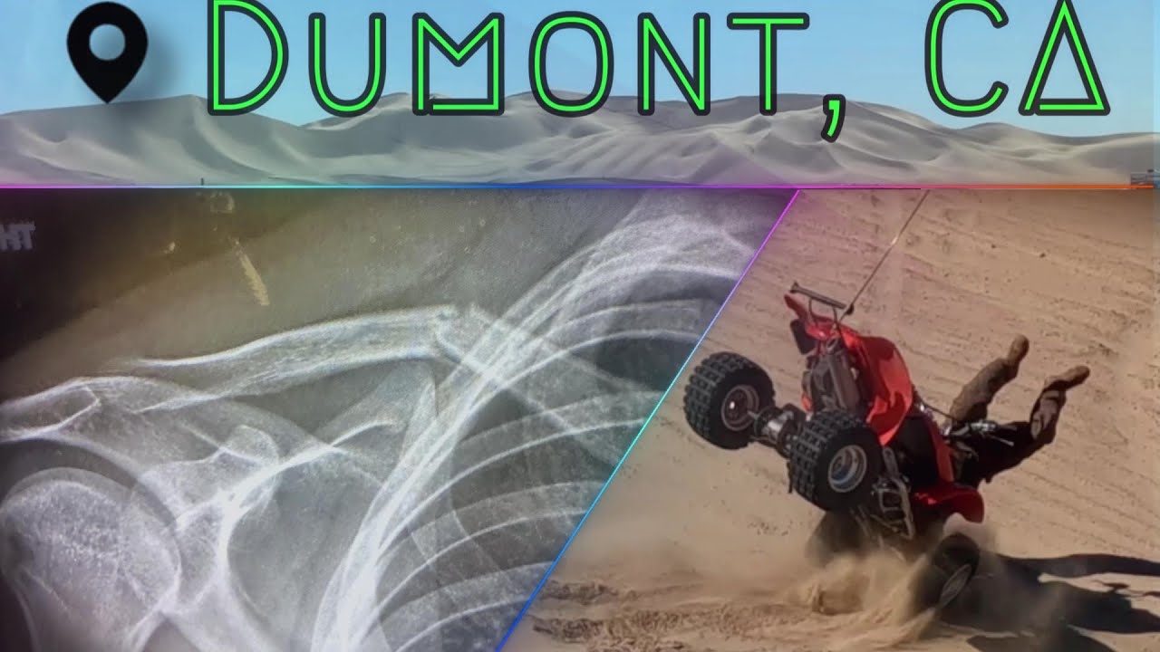 TV #15 First Time At Dumont