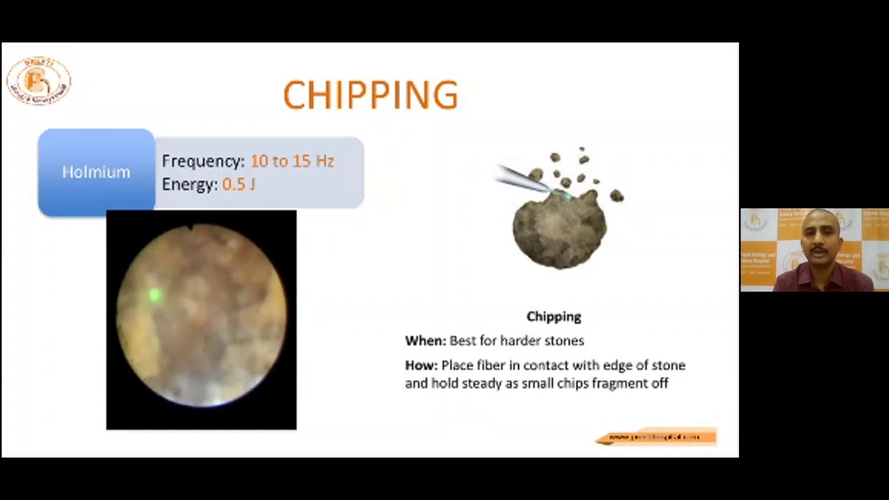 LASER SETTINGS HOLMIUM & THULIUM FIBER LASER BY DR PM SIDDALINGA SWAMY