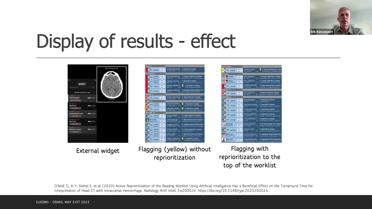 W62 Daily use of AI in radiology why and how by OSIMIS and EuSoMII