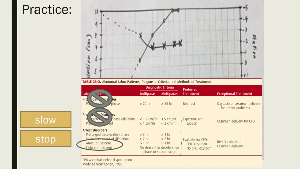 Plotting and Interpreting Abnormal Labor curves