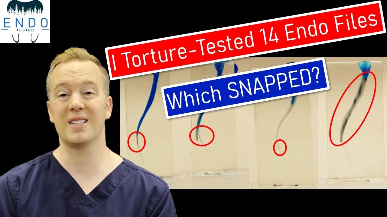 I Torture-Tested 14 Endo Files... Which SNAPPED?
