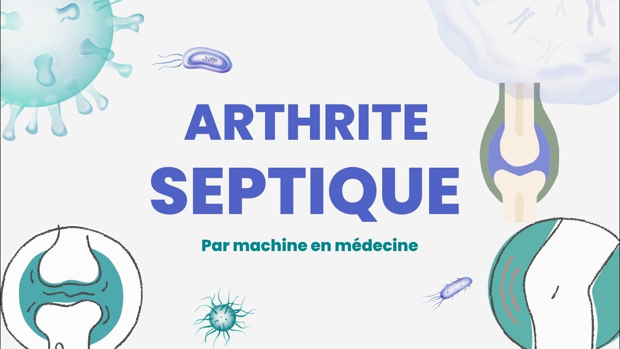 Arthrite Septique #rhumato