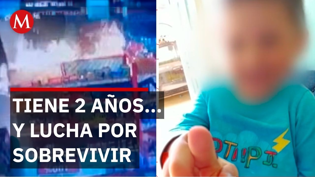 Henry, de 2 a&ntilde;os, sufri&oacute; quemaduras en tienda 3B de Chalco; denuncian negligencia