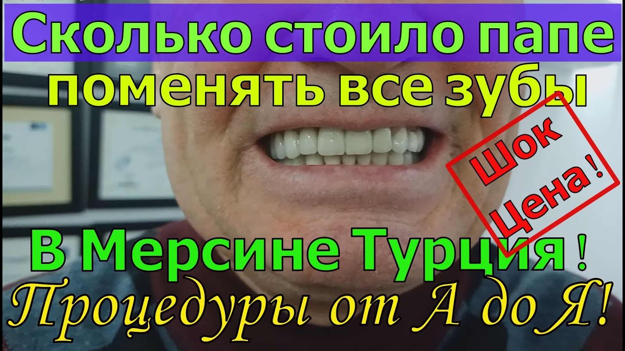 Турецкая зубная клиника в г. Мерсин. Цена и детальный обзор. Сколько стоит поменять все зубы?