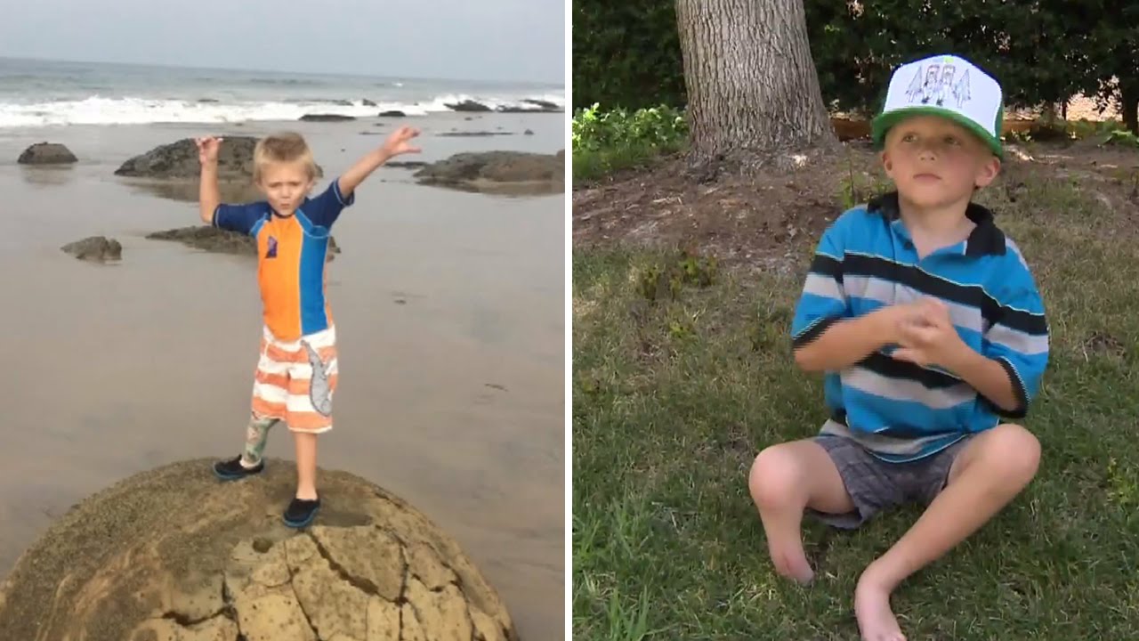 4-Year-Old Boy Has Prosthetic Leg Stolen While Going To Beach For First Time
