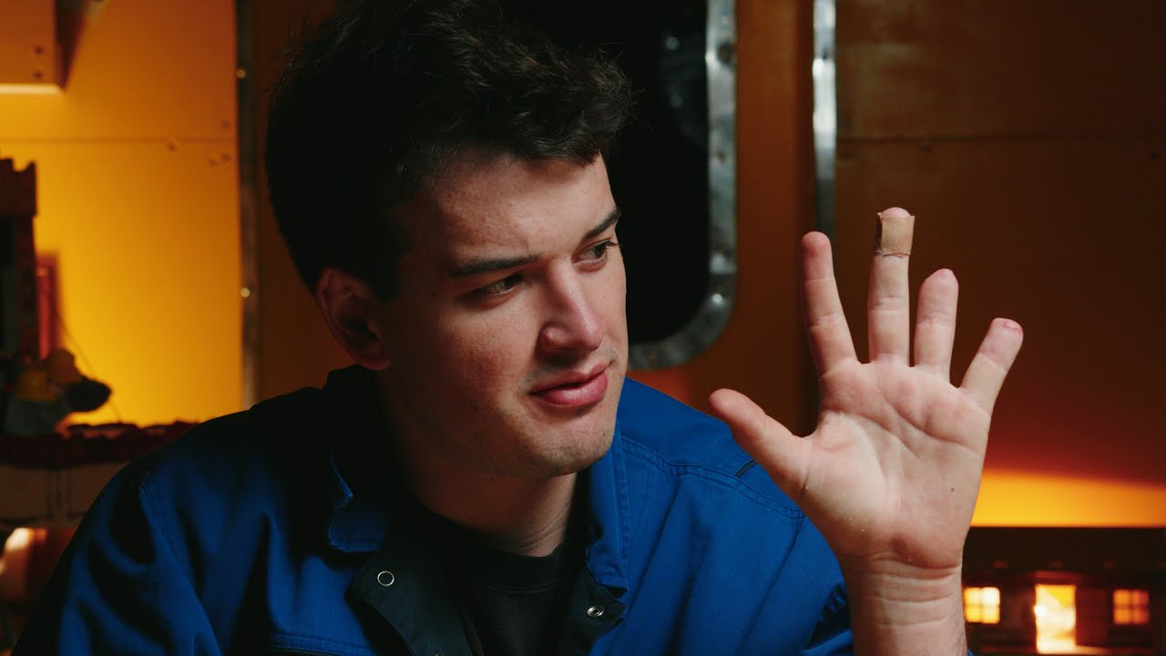 The Day I Lost 2 Fingers